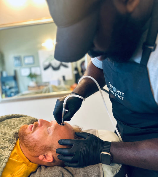 Microdermabrasion (Add on Service) - FAVORYT BRAND